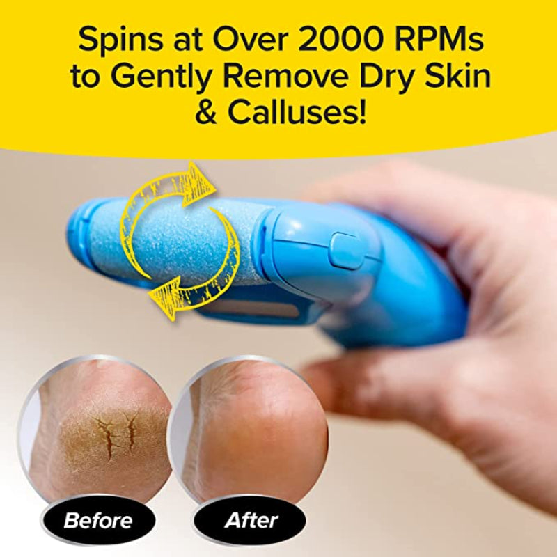 Classic And Power Callus Remover For Tough Calluses And Dry Skin