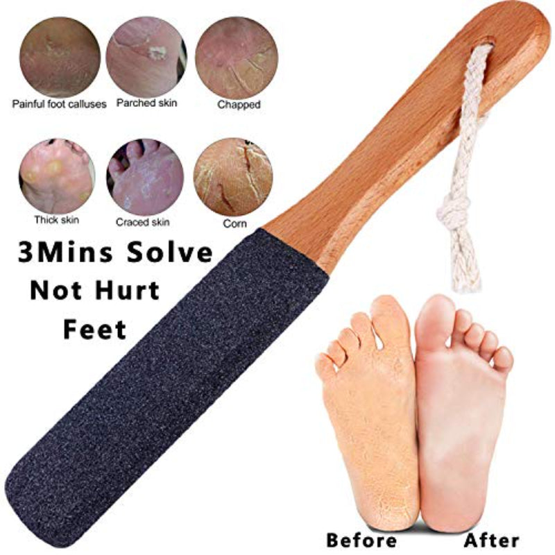 Foot File Callus Remover Foot Scrubber